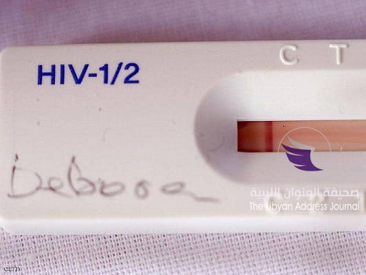 اختفاء فيروس الإيدز من ثالث مريض في العالم بعلاج جديد - 1 1233780