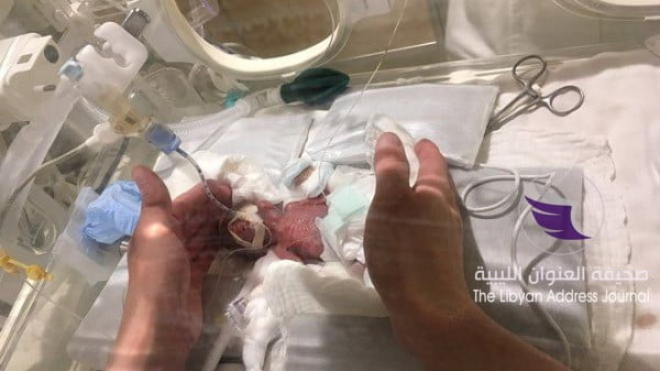 استقالة وزير الصحة بعد وفاة 11 رضيعا في إحدى المصحات بتونس - 105962536 052620642 2