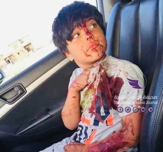 تفاصيل حادثة مقتل شخصين جراء استهداف طائرة تركية مسيرة لشاحنة وسيارة مدنية قرب سرت 5 تفاصيل حادثة مقتل شخصين جراء استهداف طائرة تركية مسيرة لشاحنة وسيارة مدنية قرب سرت - 67459620 2417277251840869 6910695279406612480 n